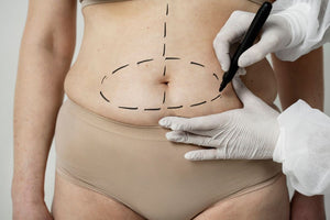 ¿Qué procedimientos requieren fajas después de cirugía?