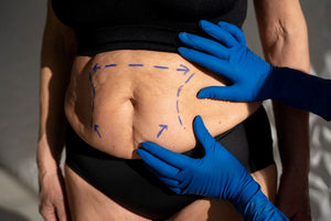 Know the stages of abdominal plastic surgery